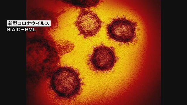  【速報】新潟市で１７１人の感染確認　新型コロナウイルス  