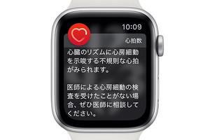 Apple Watchに心電図、なぜ重要？　米国では心房細動を発見した体験談続々 