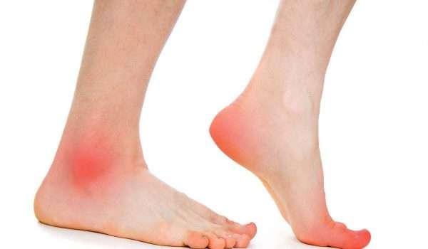 Foot fall hinders walking movement