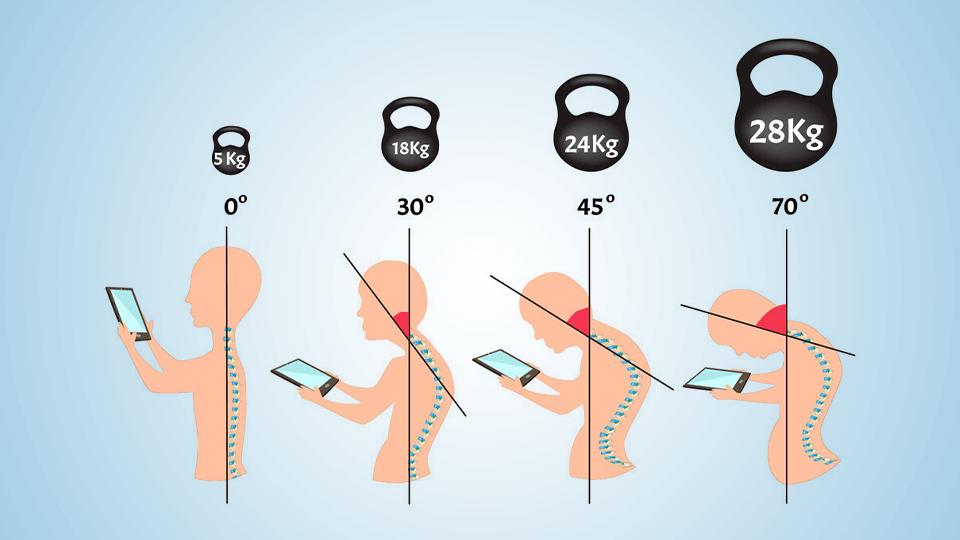 The risks of using smartphones on spine curves