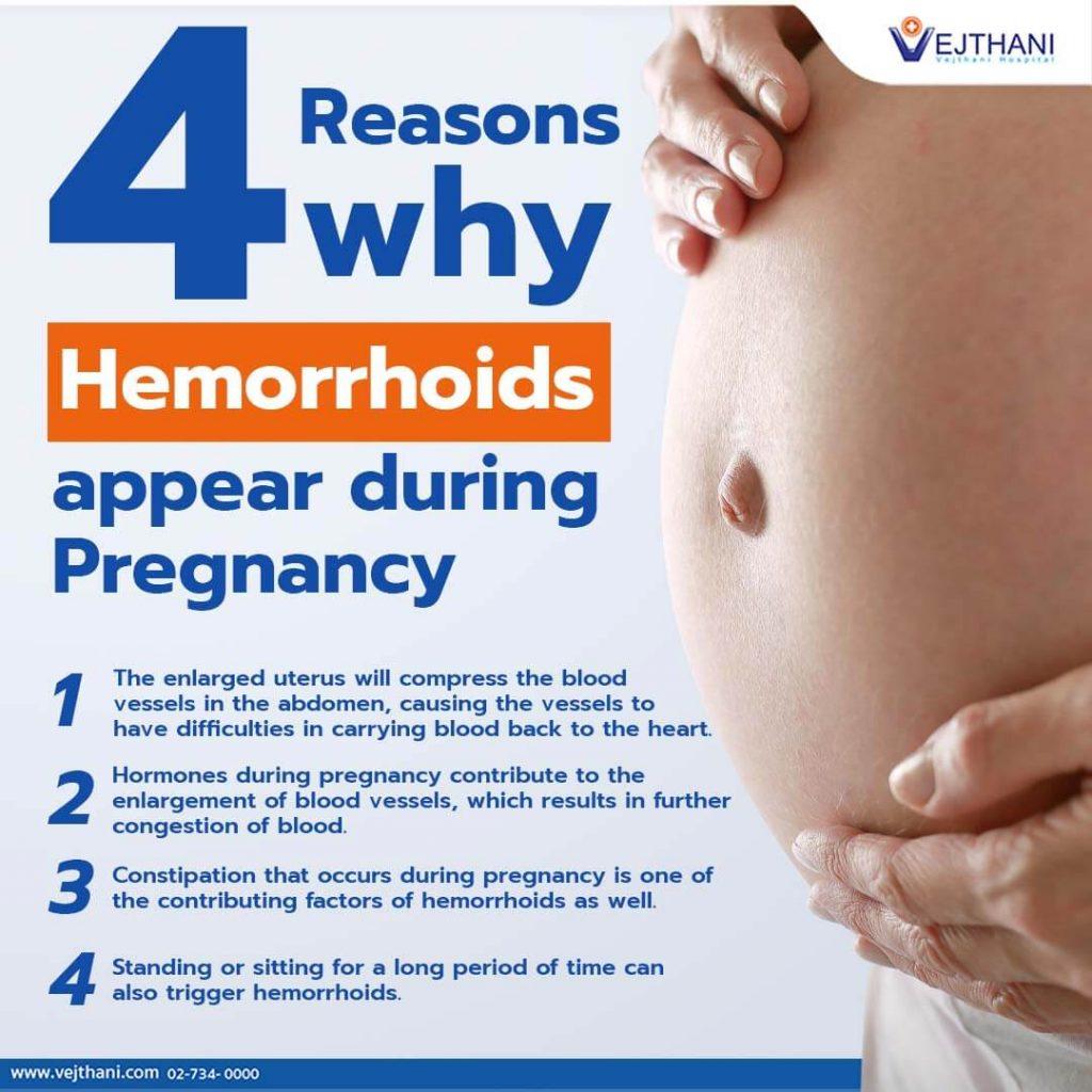 Hemorrhoids during pregnancy