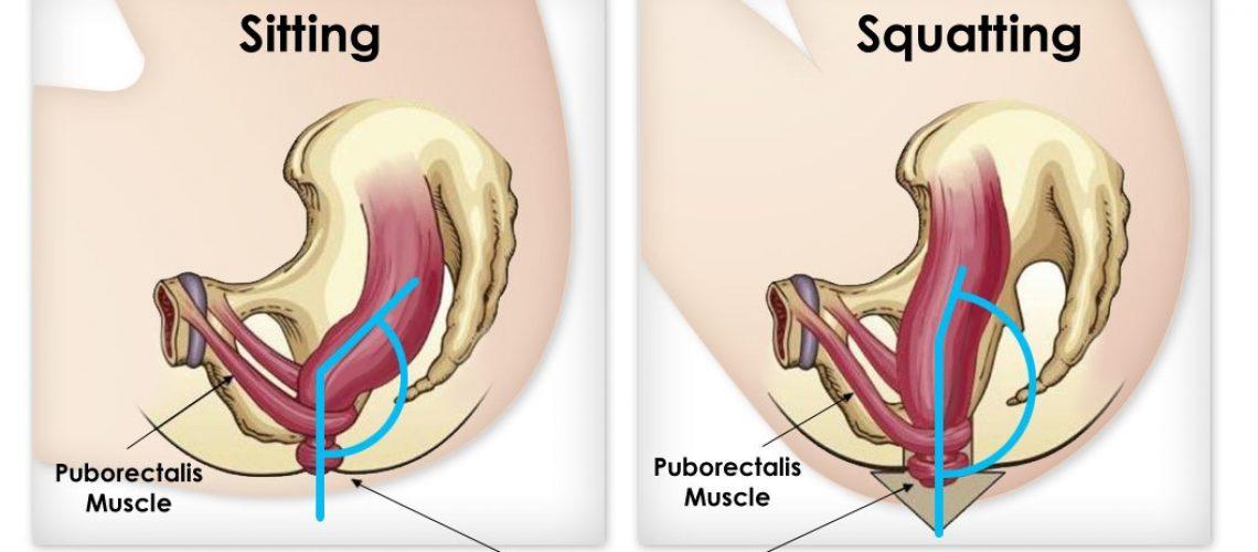 This Is the Proper Position to Poop in, According to a Doctor 