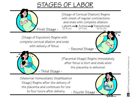 What Are the 4 Stages of Labor? 
