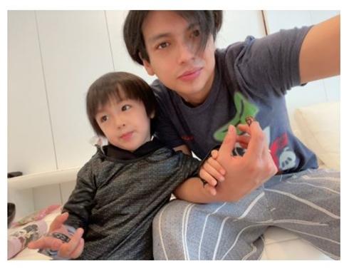 Alex & Nozomi Kawasaki, heartache at the appearance of the eldest son whose face was swollen due to severe hay fever "The worst in the morning" "I hope it gets better"