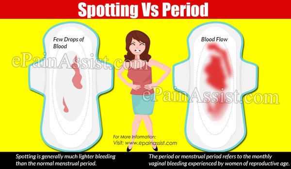 Is It Spotting or My Period? Signs, Differences, and Causes