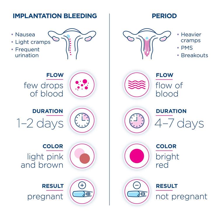 Is It Spotting or My Period? Signs, Differences, and Causes 