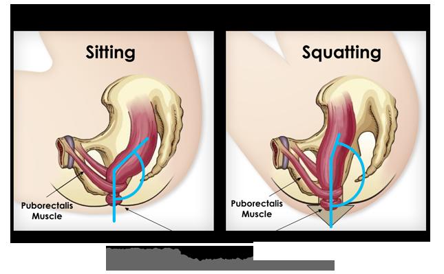 Science Says Using a Squatty Potty Really Can Improve the Way You Poop 