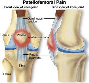 What Causes Knee Pain When Sitting?