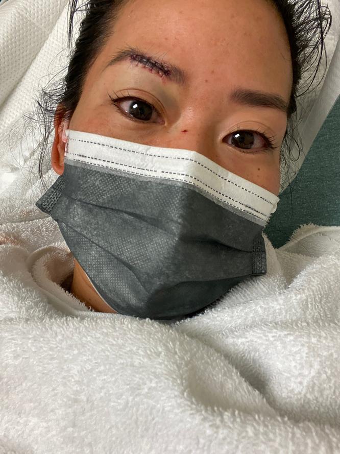 Former ‘Survivor’ contestant Michelle Yi attacked by homeless woman in Santa Monica, police say 