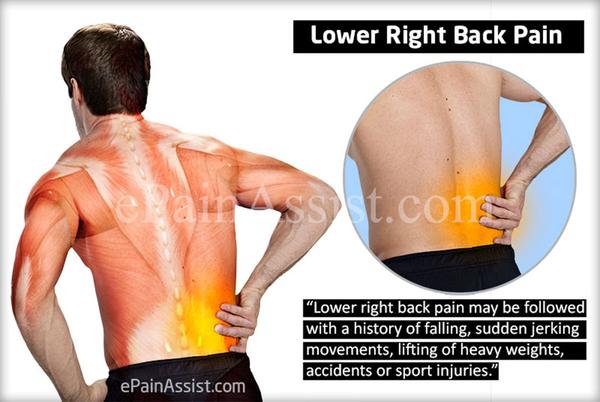 Causes of sharp lower back pain and how to remedy it 
