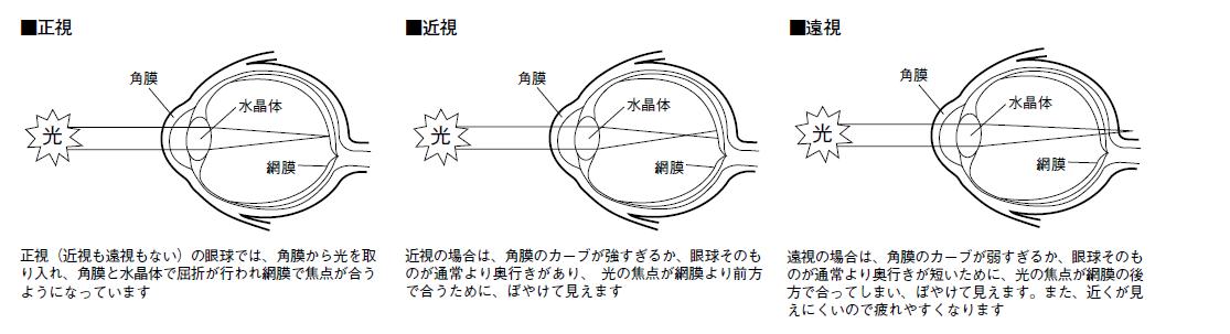 近視・遠視はどうして起こる？遠視にまつわる誤解とは｜ニュースイッチ by 日刊工業新聞社 