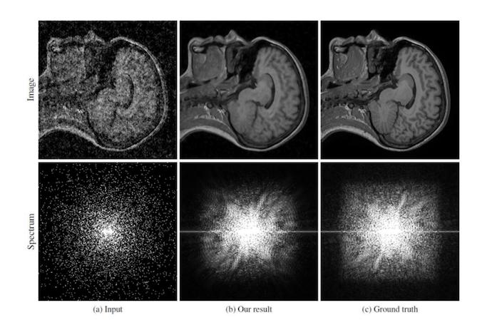 Nvidiaらの研究者がAIを使った写真のノイズ除去に成功、医療現場などでの活用に期待 