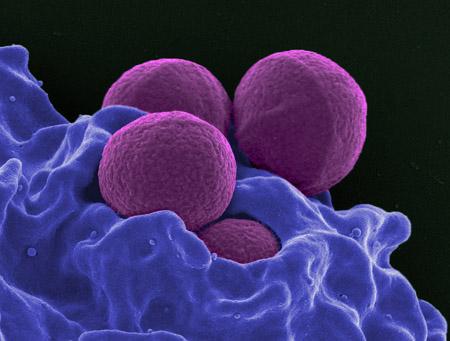 Superbugs use 'mirror images' to become antibiotic-resistant