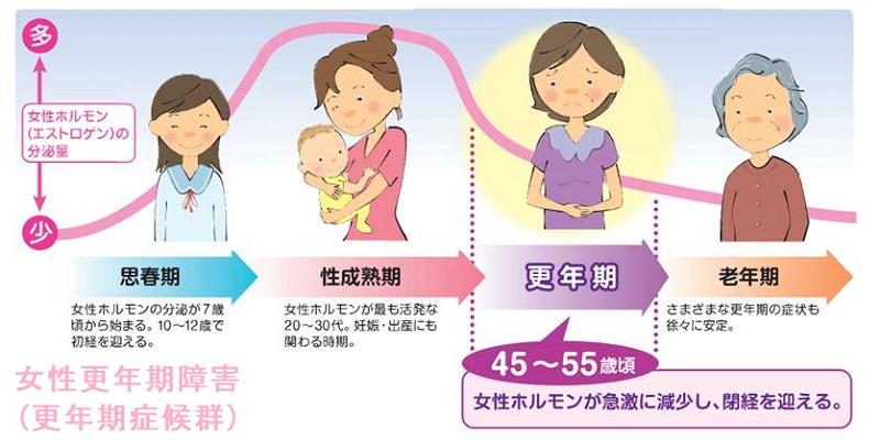 これって更年期症状⁉ バセドウ病？ 甲状腺機能亢進症の見分け方 