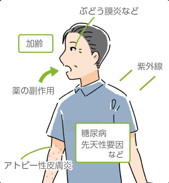  白内障は老人病？…問題は紫外線＝韓国報道 