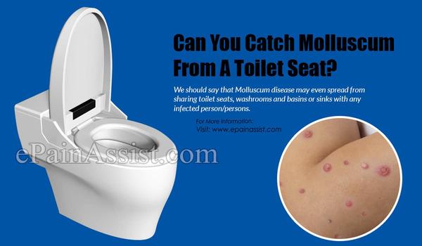Can You Get a Disease From a Toilet Seat?