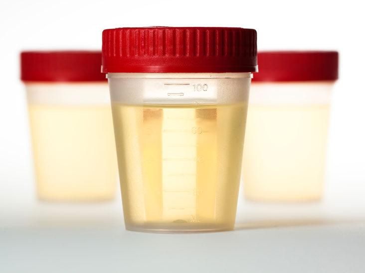 Is Urine Sterile? Fact vs. Fiction 