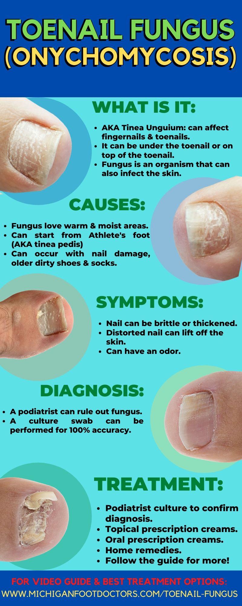Can home remedies help get rid of toenail fungus? 