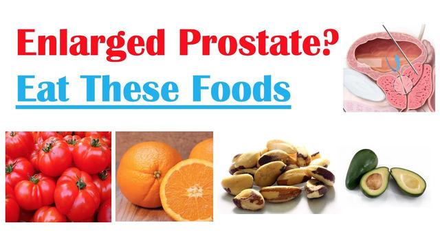 Foods, herbs to manage prostate enlargement