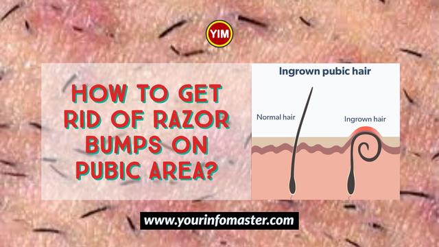 How to Treat a Razor Burn in the Pubic Area