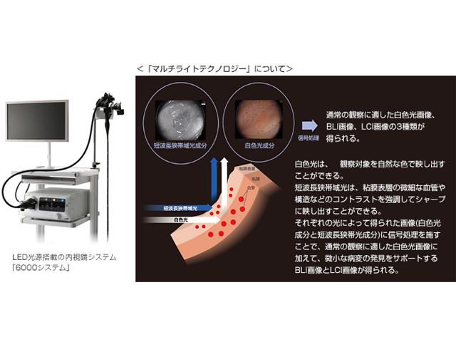 使い捨て内視鏡、コロナ禍で需要増　オリンパス・ＨＯＹＡ・富士フイルムなど開発急ぐ 