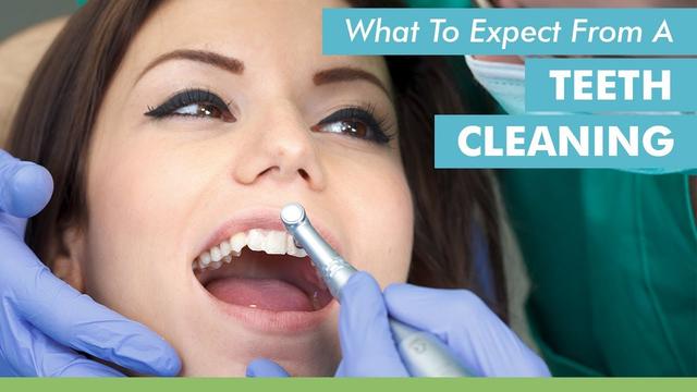 Teeth Cleaning: What to Expect