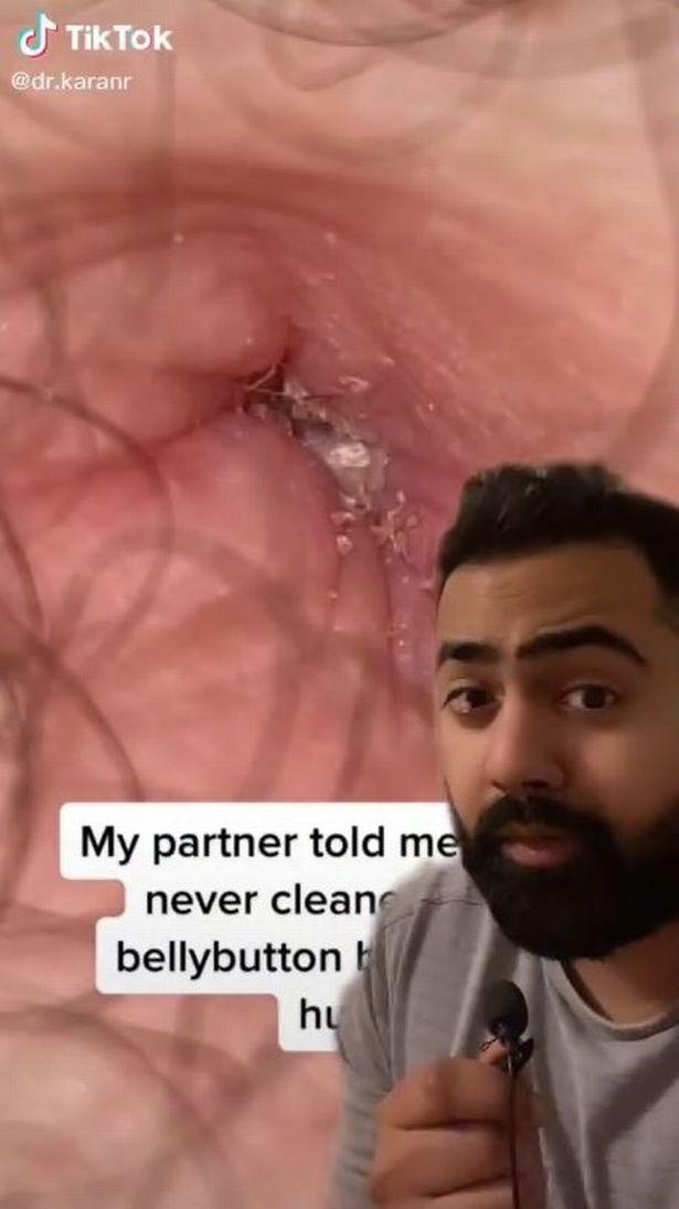 Doctor shares grim reason you should always wash your belly button properly 