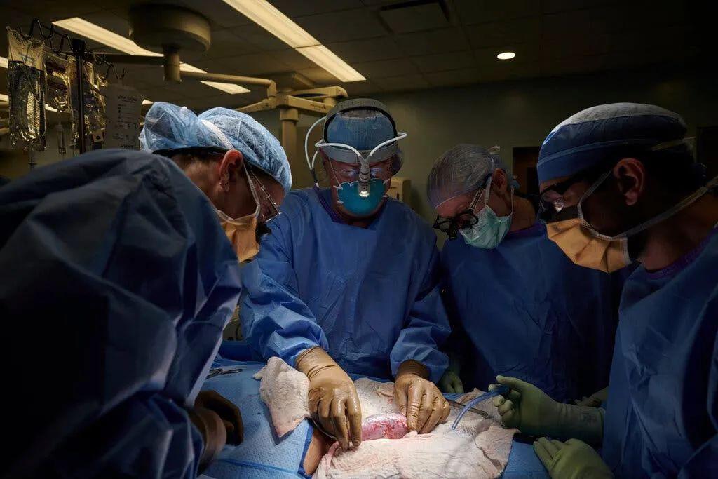 Progress in Xenotransplantation Opens Door to New Supply of Critically Needed Organs | NYU Langone News 