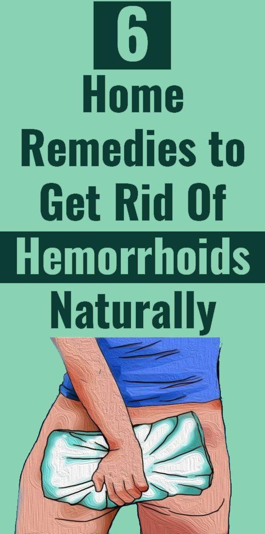 6 Home Remedies for Hemorrhoids