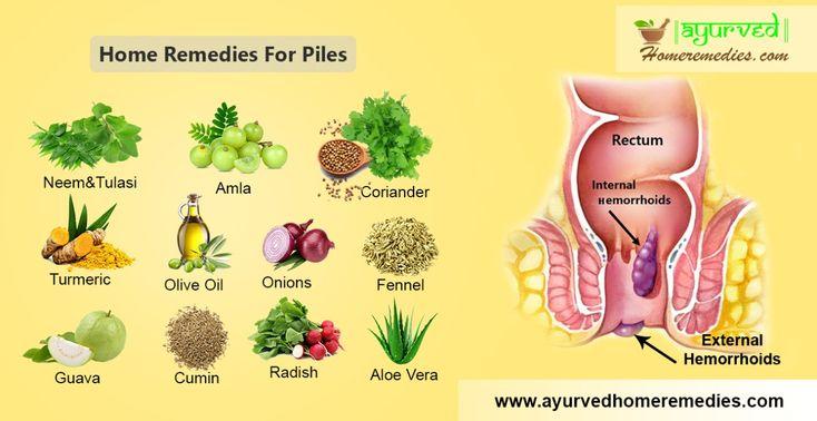 6 Home Remedies for Hemorrhoids 