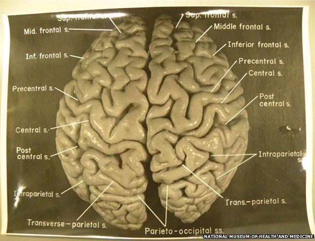 The controversial search for genius in the remains of Einstein’s brain 