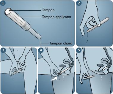 How to Insert and Remove a Tampon Correctly