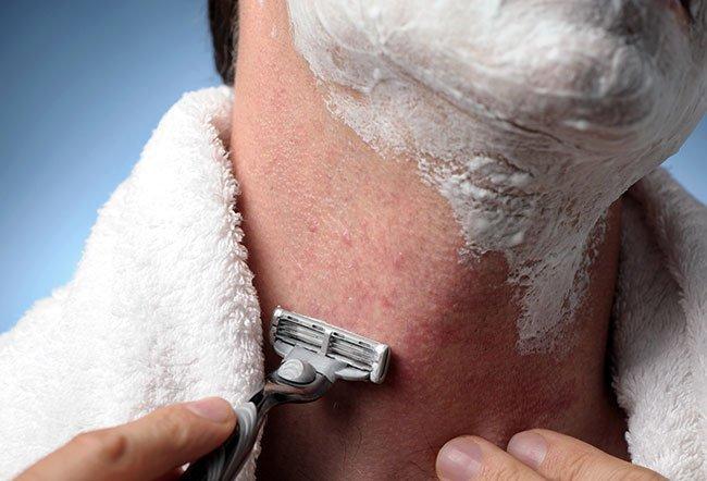 Ultimate Guide: How To Get Rid of Razor Bumps and Burns 