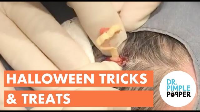 Q&A: Dr. Pimple Popper on Halloween costume-based skin irritation, inflammation