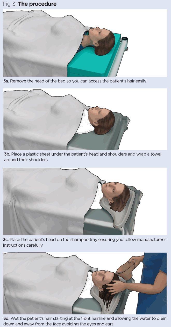 Procedure for washing patients’ hair in bed