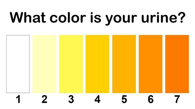 This Is What Color Your Pee Is Supposed To Be 