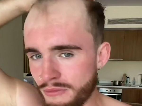 Man blows people's minds with trick to stop people noticing that he's going bald 