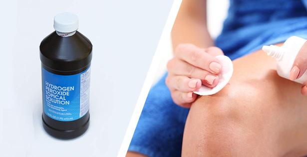 22 Healthy Uses for Hydrogen Peroxide (and a Few You Should Avoid) 