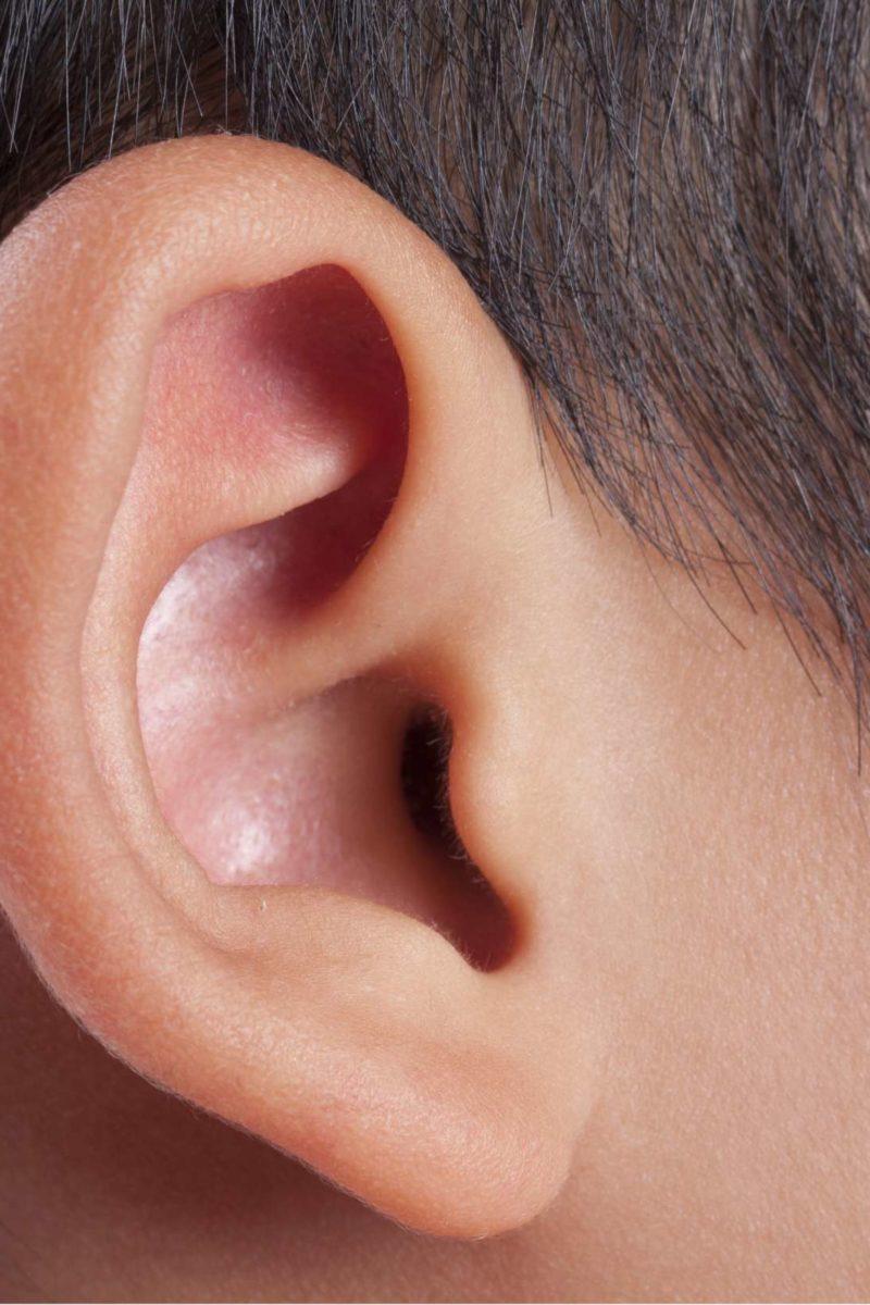 How to Get Rid of Blackheads in Ears