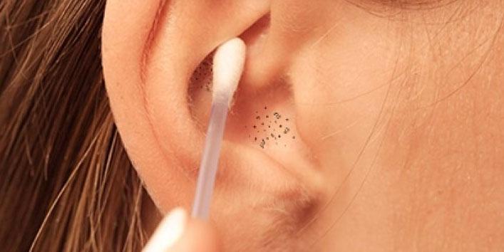 How to Get Rid of Blackheads in Ears 
