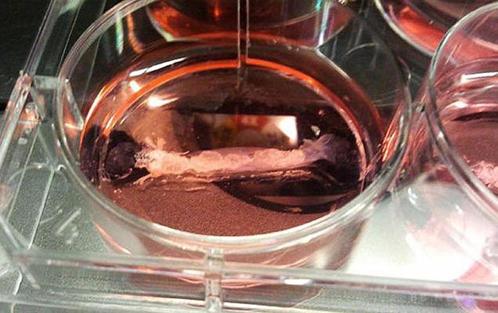 Recipes that both dinosaurs and celebrities are eaten as artificial meat: gallery
