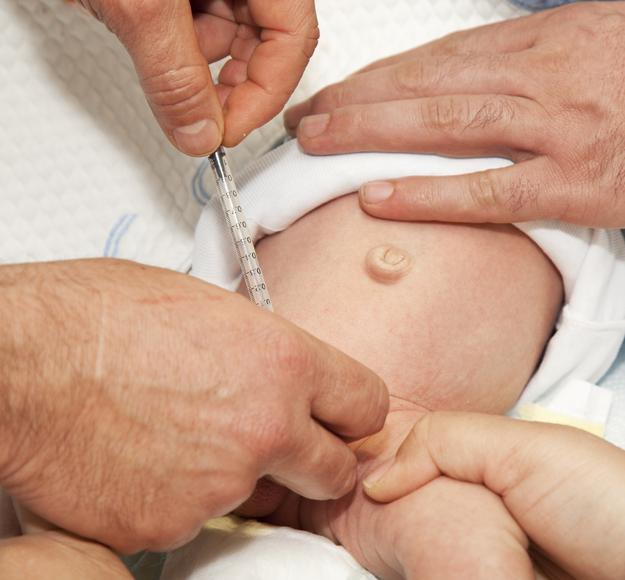 Baby circumcision: All you need to know 