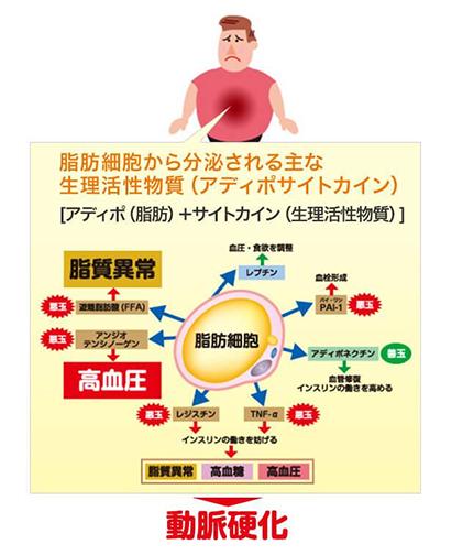 内臓脂肪はなぜ悪い？皮下脂肪との違いとは 