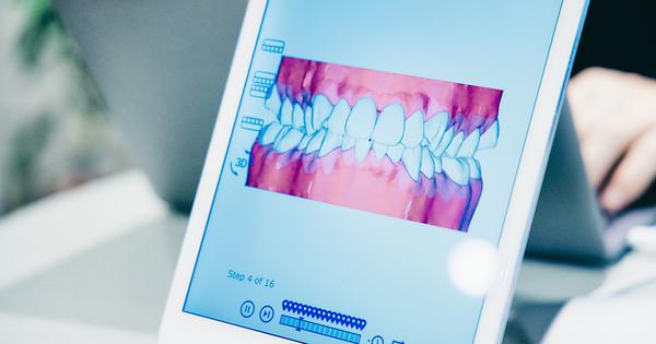 未来を創るデータドリヴンな歯科矯正サーヴィス「Oh my teeth」 