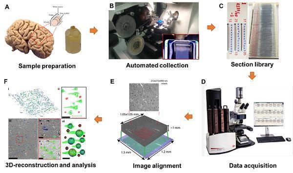Cellular 3D-reconstruction and analysis in the human cerebral cortex using automatic serial sections 