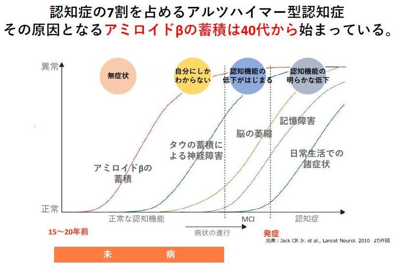  【40代から始める認知症対策】チェックリストで確認！あなたには、まだ認知症の症状がない？