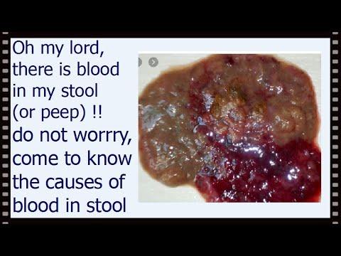 Why Do I Have Blood in My Stool? 
