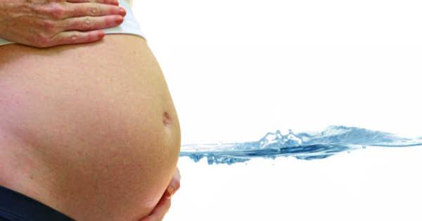 My Water Broke, but I’m Not Having Contractions — What Now? 