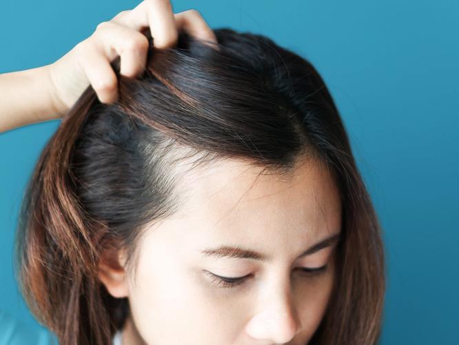 What causes a dry scalp, and how can you treat it? 