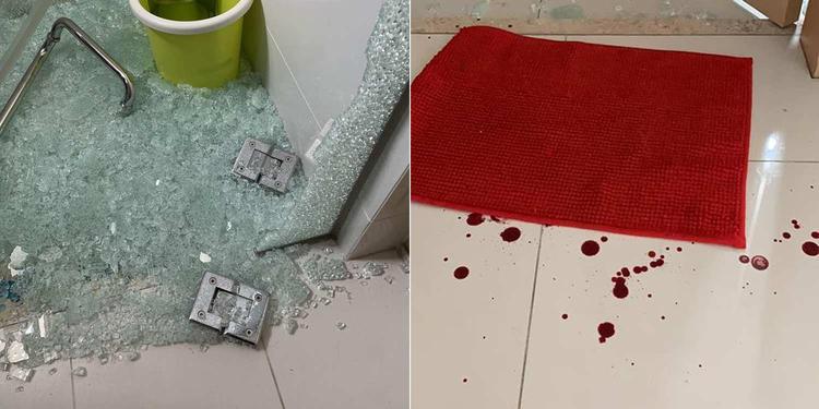Mum warns against installing tempered glass shower panels after daughter injured by spontaneous breakage